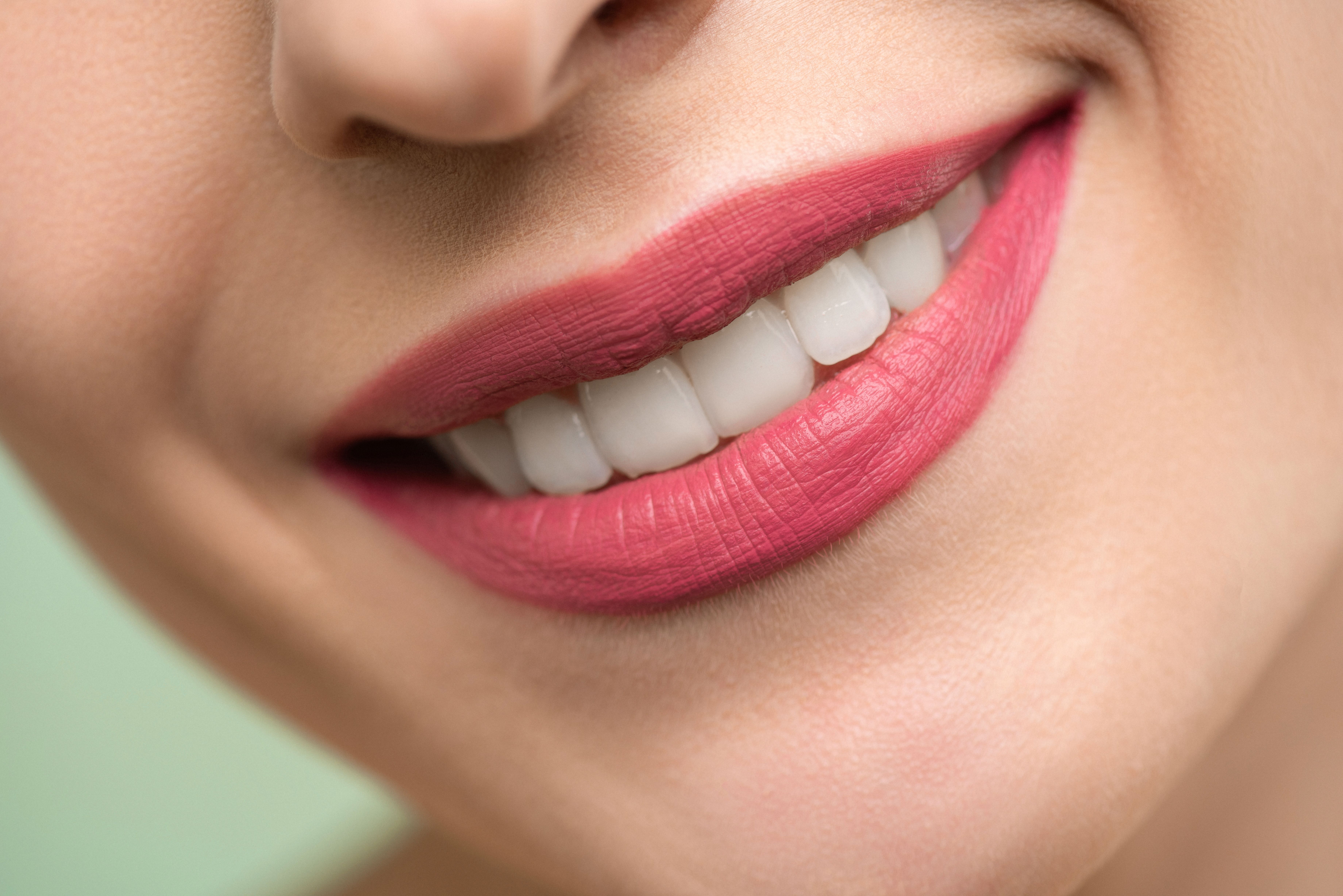 Sorriso in primo piano, immagine illustrativa dello sbiancamento